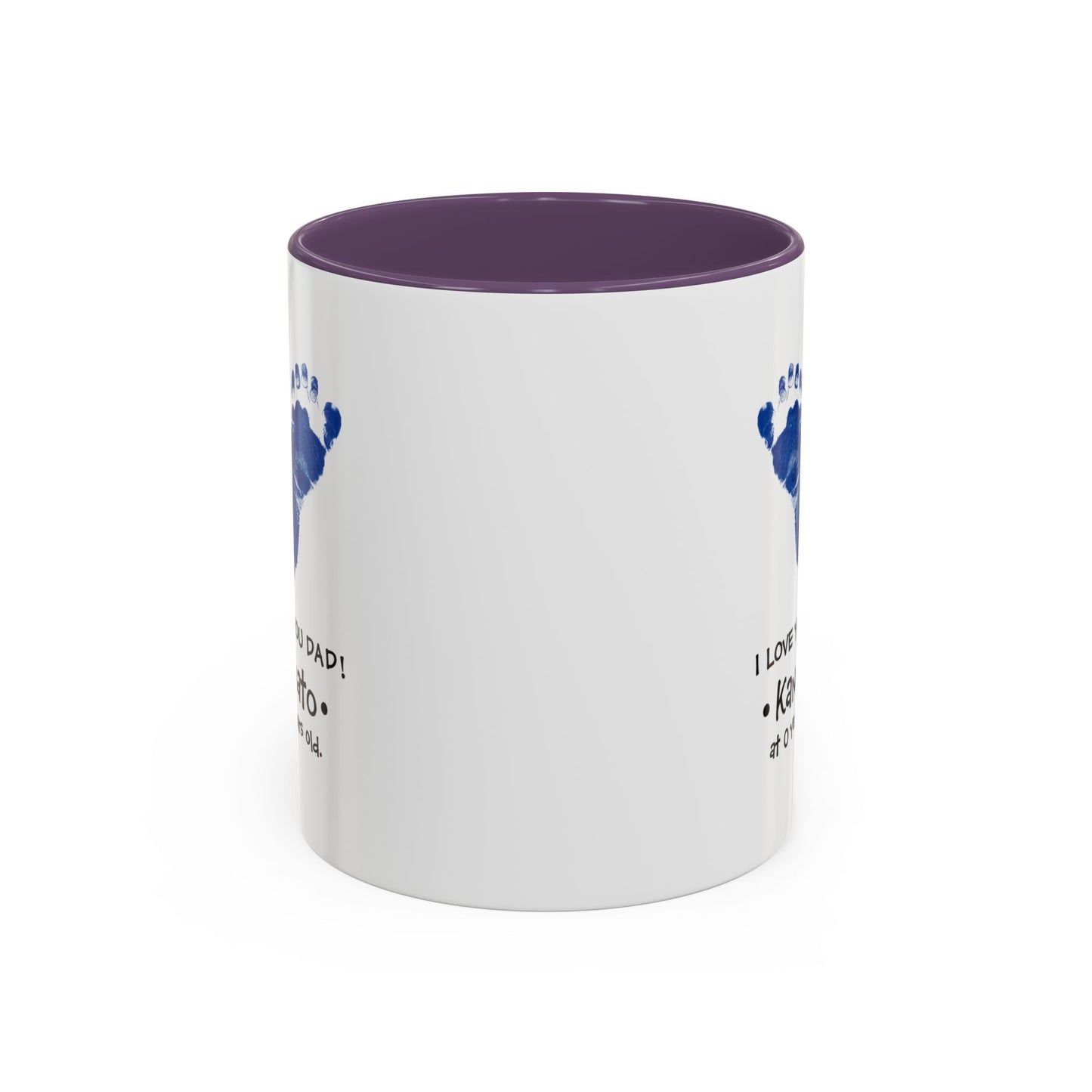 dad  Accent Coffee Mug (11, 15oz)